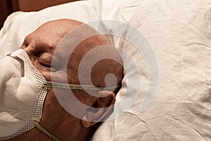 Head of a man wearing a respirator, asleep on hospital pillow, bald chemotherapy coronavirus, creative copy space