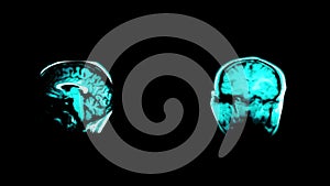 Head MRI footage 4K. Brain x ray on black background