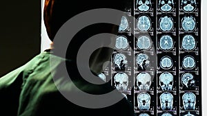 Head MRI, surgeon observing skull brain x-ray film, analysis