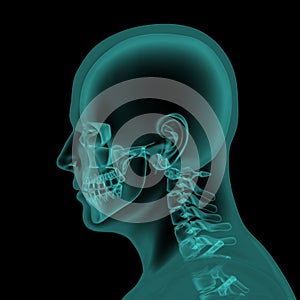 Head and neck x-ray scan