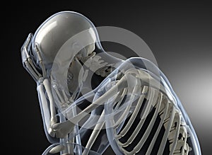 Head Pain X-ray concept