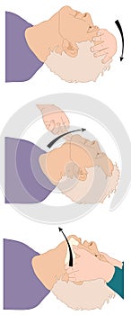 Head position for open airway