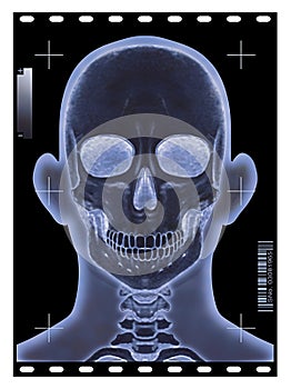 Head X-ray