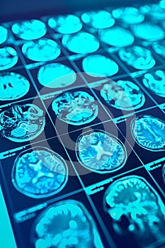 Head scanning series with brain structure