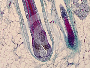 Head skin with hair follicles. Root of hair under the microscope