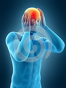 Headache/ migraine