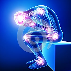 Headache / migraine with joint pain photo