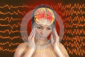 Headache, migraine, stroke, conceptual illustration showing a woman with pain in head on a background with migraine EEG waves