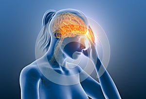 Headache, migraine of a woman, medically 3D illustration on blue background photo