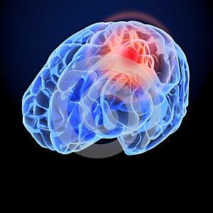 Headache X-Ray 3D model. Brain neurons synapse, anatomy body. Medical illustration of disease, head pain