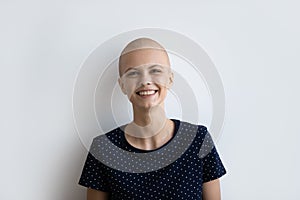 Headshot portrait of smiling hairless woman struggle with oncology