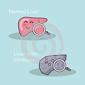 Health liver vs cirrhosis liver