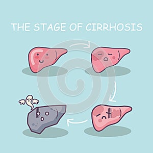 Health liver vs cirrhosis liver