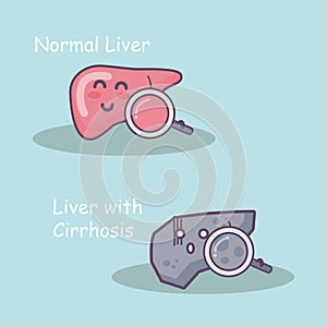 Health liver vs cirrhosis liver photo