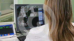 Healthcare concept. Doctor in Hospital looking at CT scan. Over the Shoulder Shot of female Medical Scientist Working