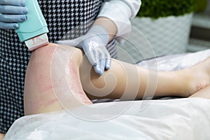 Healthcare Ideas. Close-up Of A Beautician Doing Depilation With Hot Wax On Woman`s Leg Using Wax Device In Spa