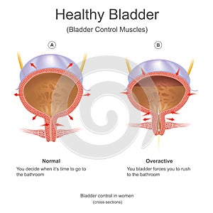 Healthy bladder in women. photo