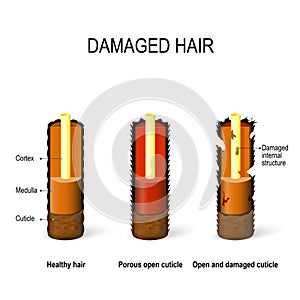 Healthy and damaged hair