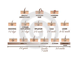 Healthy growth hair. Ingrown hair. Hair growth phases. Different methods of hair removal