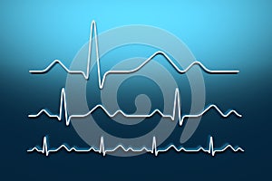 Healthy heart  beat line on blue background