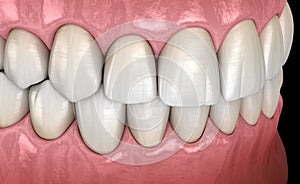 Healthy human teeth with normal occlusion, side view. Medically accurate tooth
