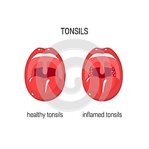 Tonsils vector illustration