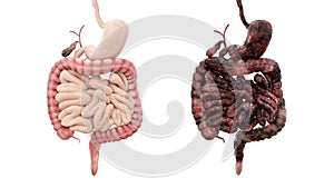 Salutare intestini un malattia intestini su bianco isolato. autopsia medico. cancro un 