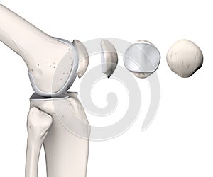 Healthy Knee Joint Anatomy. Patella. Labeled. 3D llustration