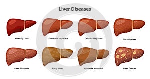 Healthy Liver and Liver diseases - fatty liver, hepatitis, fibrosis, cirrhosis, alcoholic hepatitis, liver cancer - photo