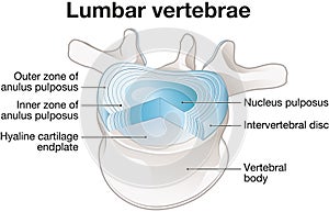 Healthy lumbar vertebrae and intervertebral disc. Labeled illustration