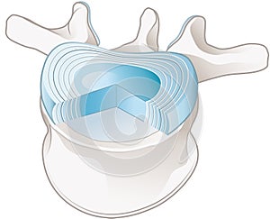 Healthy lumbar vertebrae and intervertebral disc. Labeled illustration photo