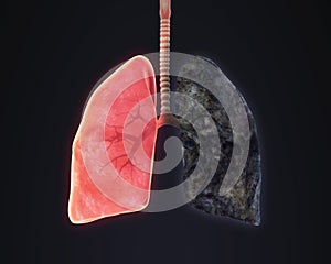 Healthy Lung and Smokers Lung