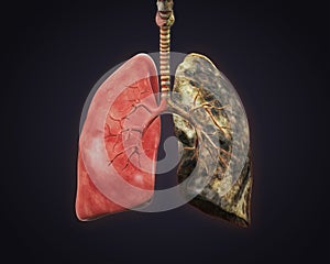 Saludable pulmones a fumadores pulmones 