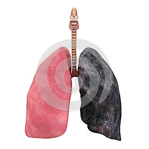 Healthy Lung and Smokers Lung Isolated