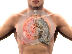 Zdravý pľúca a fajčiari pľúca 
