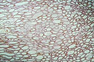 Healthy lung tissue with alveoli