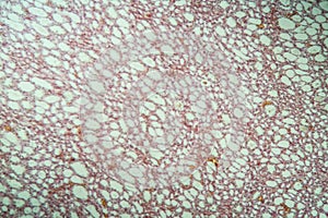 Healthy lung tissue with alveoli