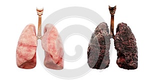 Healthy lungs and disease lungs on white isolate. Autopsy medical concept. Cancer and smoking problem.