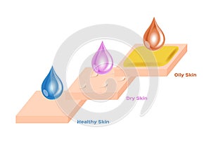 Healthy oily and dry skin serum drop  photo