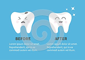 Healthy smiling tooth icon. Shining star. Crying bad ill teeth with caries. Before after Infographic Template with text. Cute char