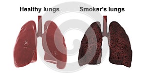 Healthy and smoker`s lungs isolated on white background, medical concept,