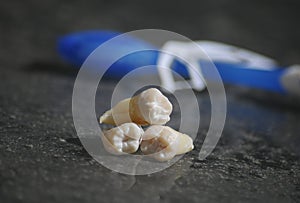 Healthy teeth and cavity tooth on grey dentist background photo