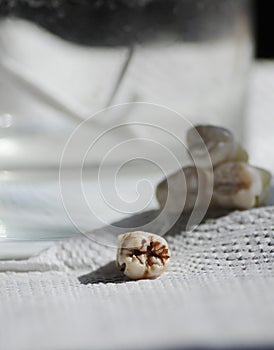 Healthy teeth and cavity tooth on white dentist background