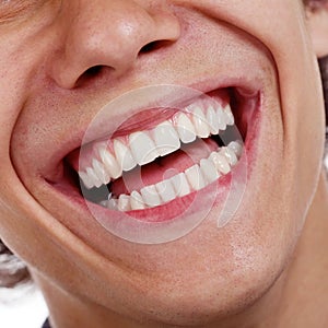 Healthy teeth closeup photo