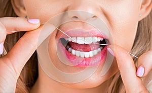 Healthy teeth concept. Teeths Flossing. Oral hygiene and health care. Smiling women use dental floss white healthy teeth