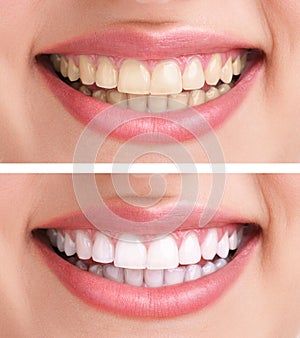 Healthy teeth and smile photo