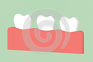 Healthy tooth