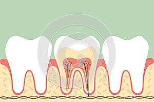 Healthy tooth anatomy