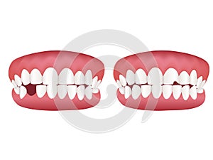 Healthy tooth model