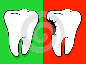 Healthy And Unhealthy Tooth Cartoon caries